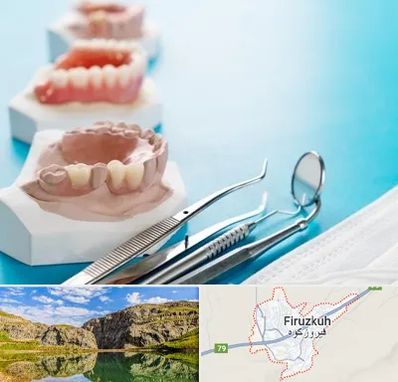 متخصص روکش دندان در فیروزکوه