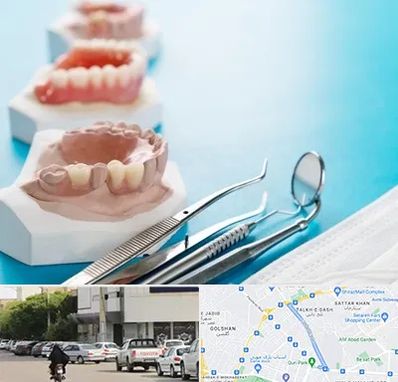 متخصص روکش دندان در قدوسی شرقی شیراز