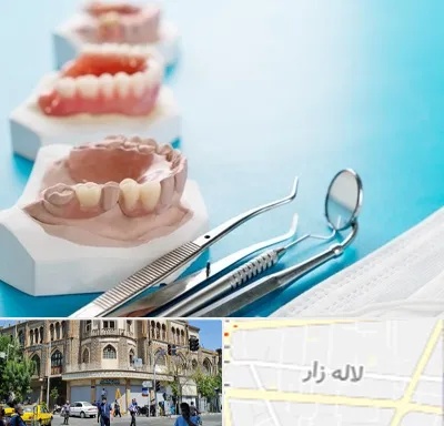 متخصص روکش دندان در لاله زار