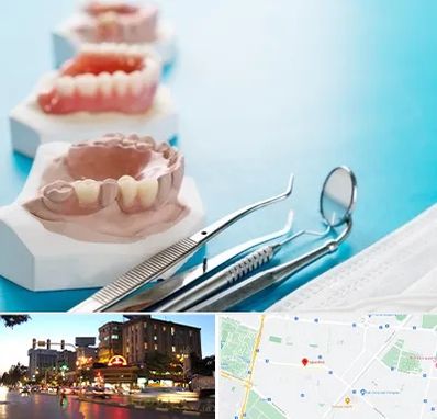 متخصص روکش دندان در بلوار سجاد مشهد 