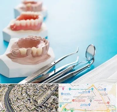 متخصص روکش دندان در شهرک غرب مشهد 