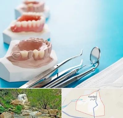 متخصص روکش دندان در کردان