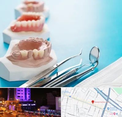 متخصص روکش دندان در آبرسان تبریز