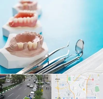 متخصص روکش دندان در ستارخان 