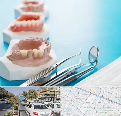 متخصص روکش دندان در مفتح مشهد 