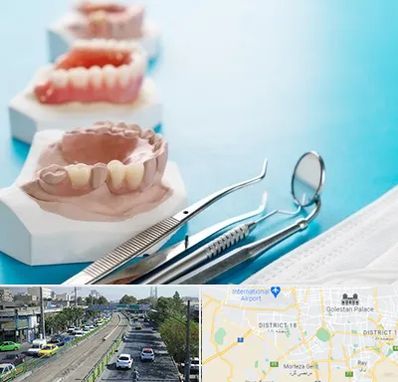 متخصص روکش دندان در جنوب تهران 