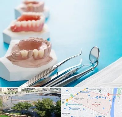 متخصص روکش دندان در گلستان اهواز 
