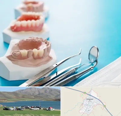 متخصص روکش دندان در دهگلان