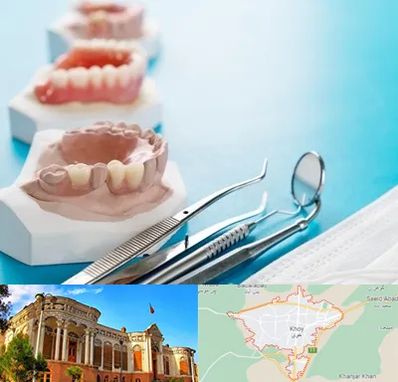 متخصص روکش دندان در خوی