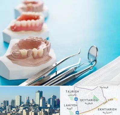 متخصص روکش دندان در قیطریه 