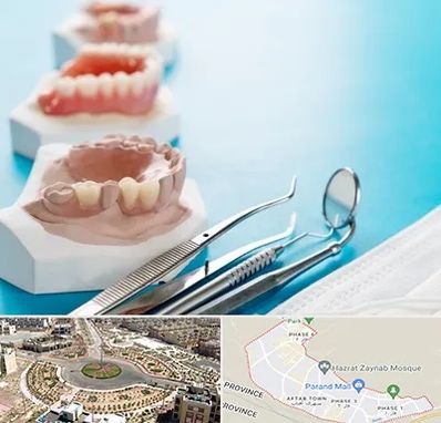 متخصص روکش دندان در پرند