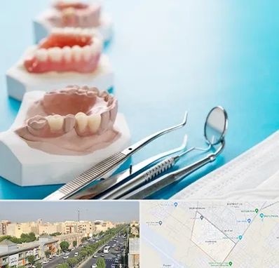 متخصص روکش دندان در کیانمهر کرج 