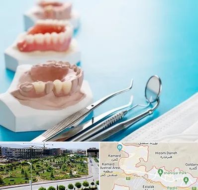 متخصص روکش دندان در پردیس