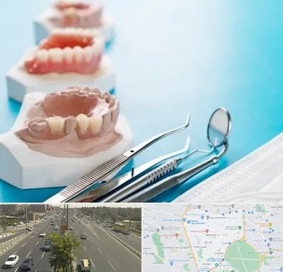 متخصص روکش دندان در منطقه 17 تهران 