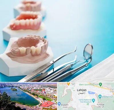 متخصص روکش دندان در لاهیجان