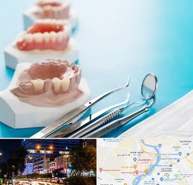 متخصص روکش دندان در کیانپارس اهواز 