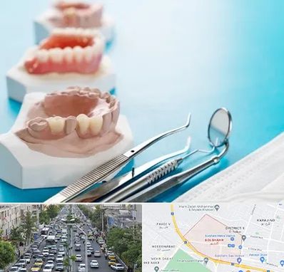 متخصص روکش دندان در گلشهر کرج 