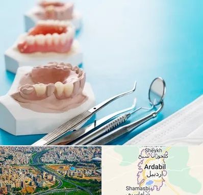 متخصص روکش دندان در اردبیل