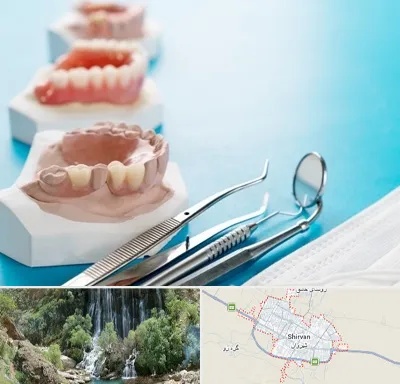 متخصص روکش دندان در شیروان