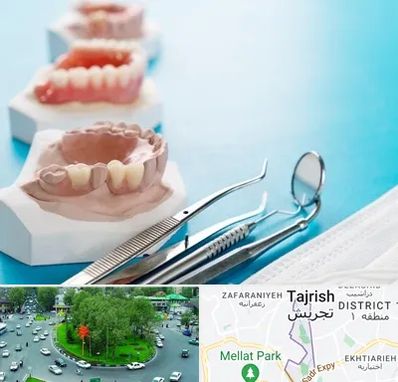 متخصص روکش دندان در تجریش 