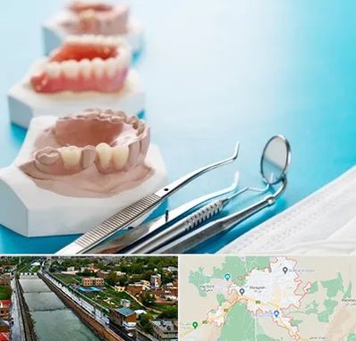 متخصص روکش دندان در مراغه