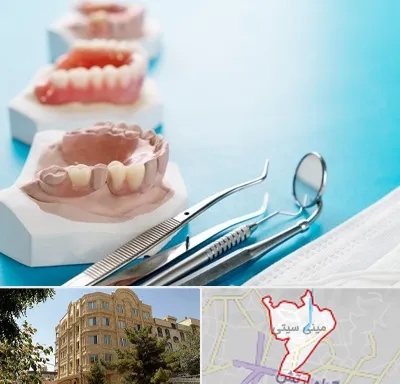 متخصص روکش دندان در مینی سیتی