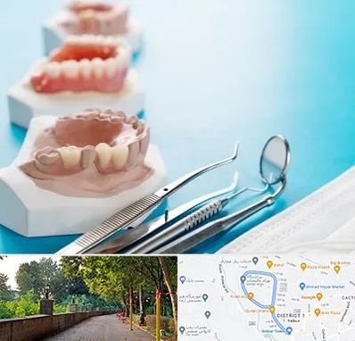 متخصص روکش دندان در فلکه گاز رشت 