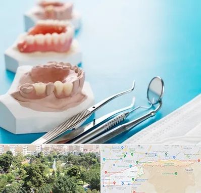 متخصص روکش دندان در منطقه 13 تهران 