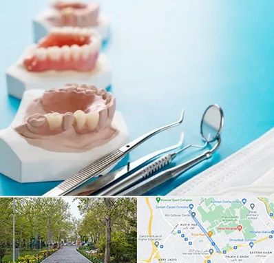 متخصص روکش دندان در قدوسی غربی شیراز 