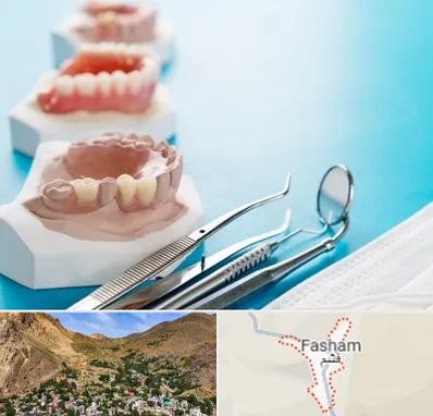 متخصص روکش دندان در فشم