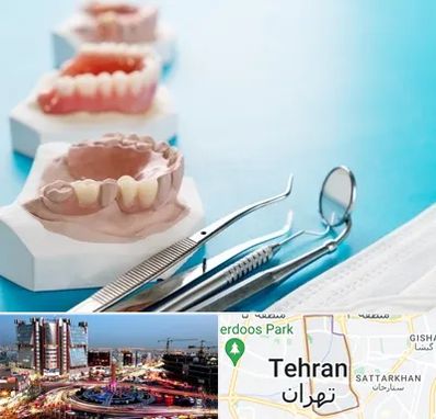 متخصص روکش دندان در صادقیه 