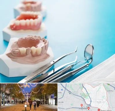 متخصص روکش دندان در ولیعصر ارومیه