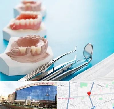 متخصص روکش دندان در نصف راه تبریز