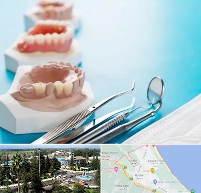 متخصص روکش دندان در رودسر