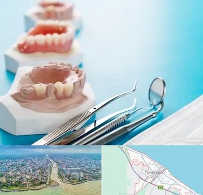 متخصص روکش دندان در تنکابن