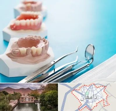 متخصص روکش دندان در دامغان