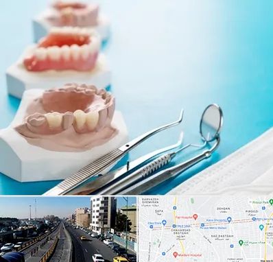 متخصص روکش دندان در پیروزی 