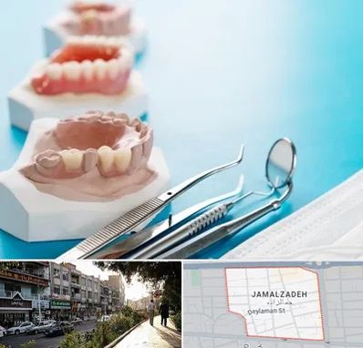 متخصص روکش دندان در خیابان جمالزاده