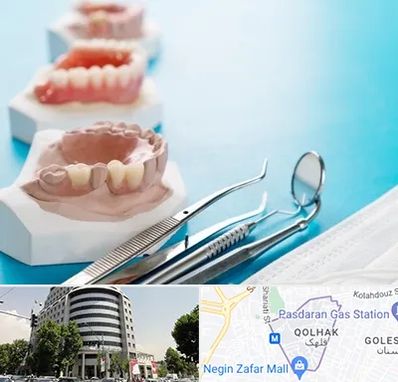 متخصص روکش دندان در قلهک 