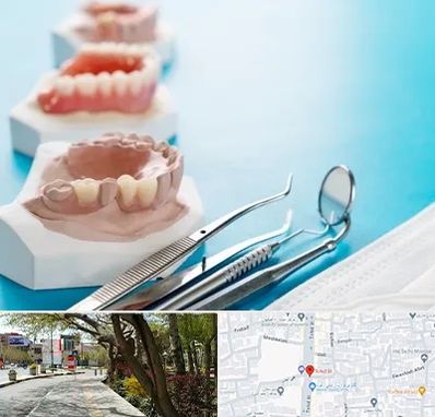 متخصص روکش دندان در خیابان توحید اصفهان 