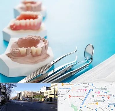 متخصص روکش دندان در خیابان ملاصدرا شیراز 