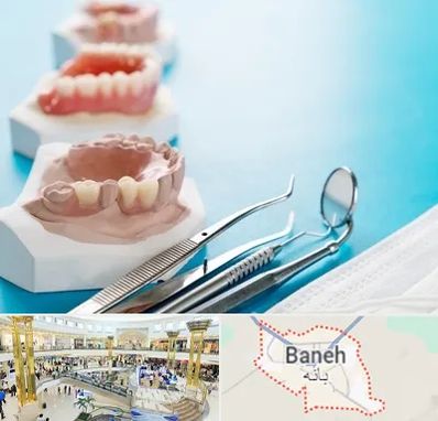 متخصص روکش دندان در بانه