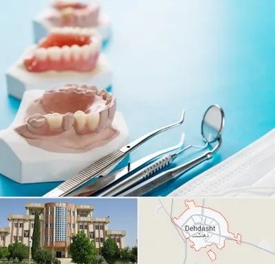 متخصص روکش دندان در دهدشت