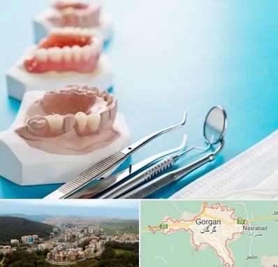 متخصص روکش دندان در گرگان