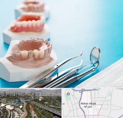 متخصص روکش دندان در عباس آباد تهران