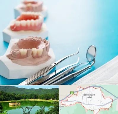 متخصص روکش دندان در بهشهر