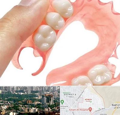 پروتز متحرک دندان در عظیمیه کرج 