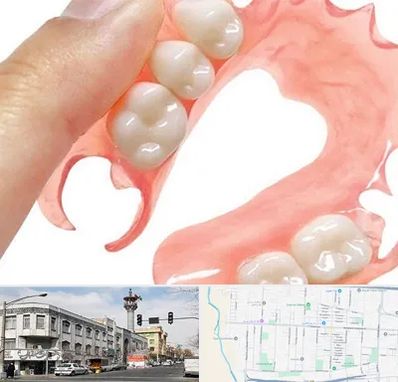 پروتز متحرک دندان در 17شهریور