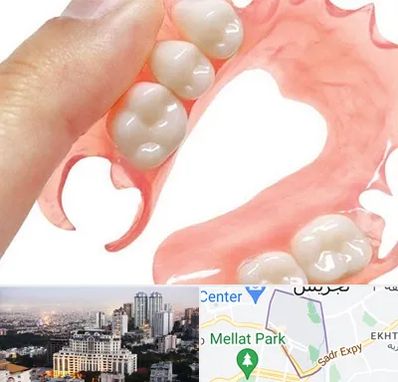 پروتز متحرک دندان در الهیه 