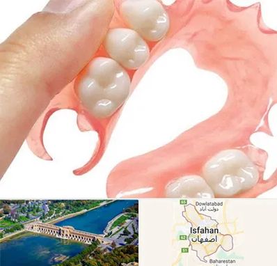 پروتز متحرک دندان در اصفهان